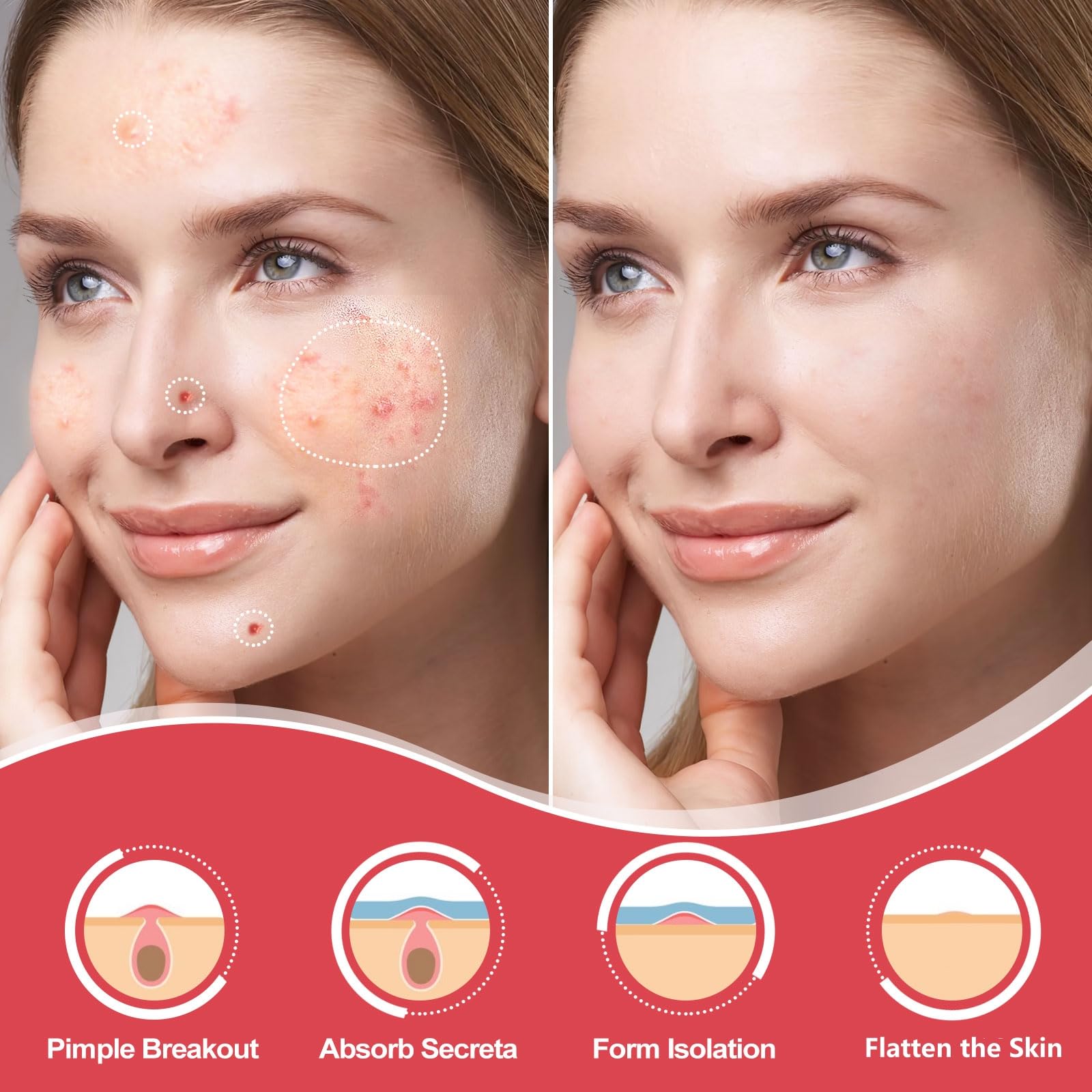 AcneGo hydrocolloid patches on skin show strong adhesion and water-resistant protection for overnight use.
