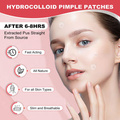 AcneGo patches available in 8mm and 12mm sizes fit blemishes precisely for faster healing.