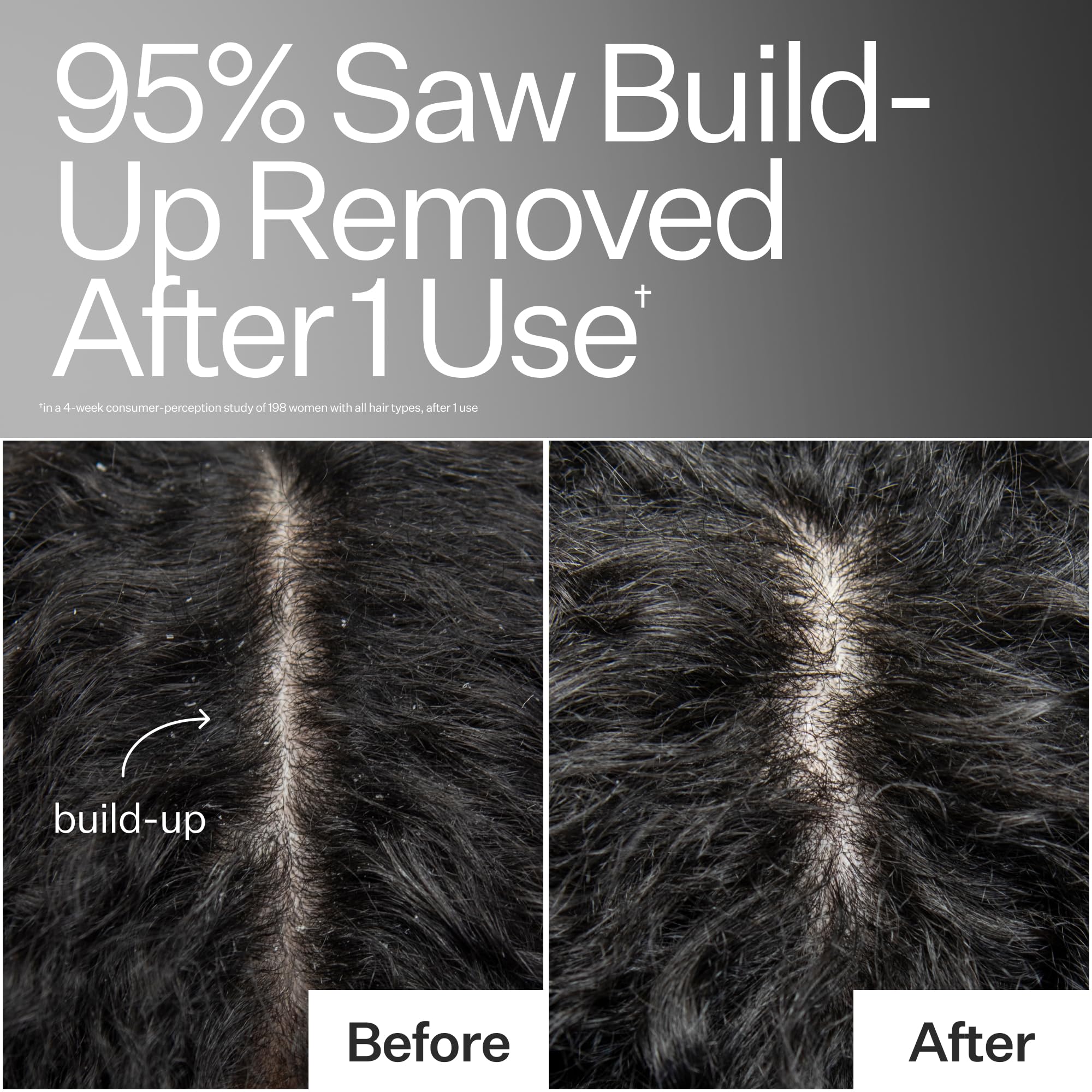 ACT+ ACRE baobab oil nutrients support hair follicles for healthier-looking strands