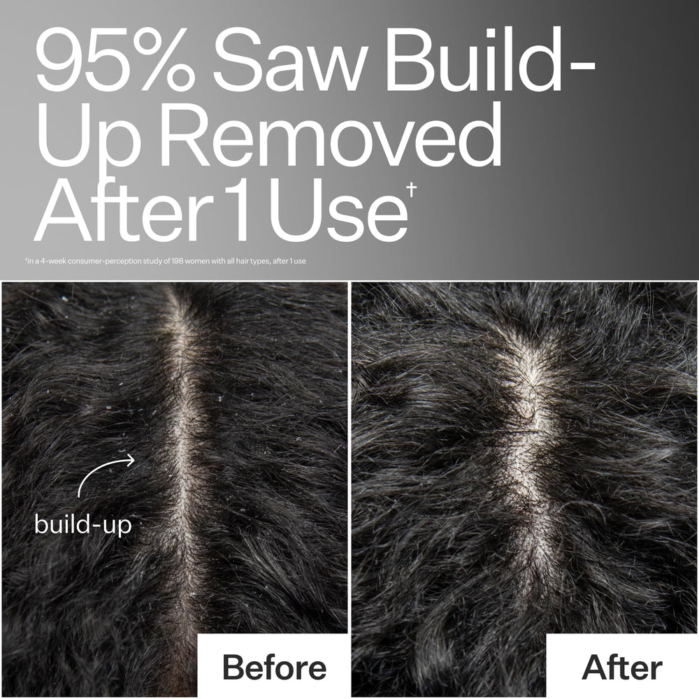 ACT+ ACRE baobab oil nutrients support hair follicles for healthier-looking strands