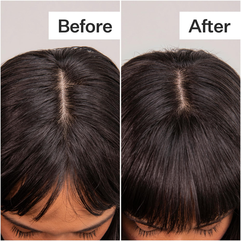 ACT+ ACRE oil-absorption at the scalp promotes refreshed roots without residue.