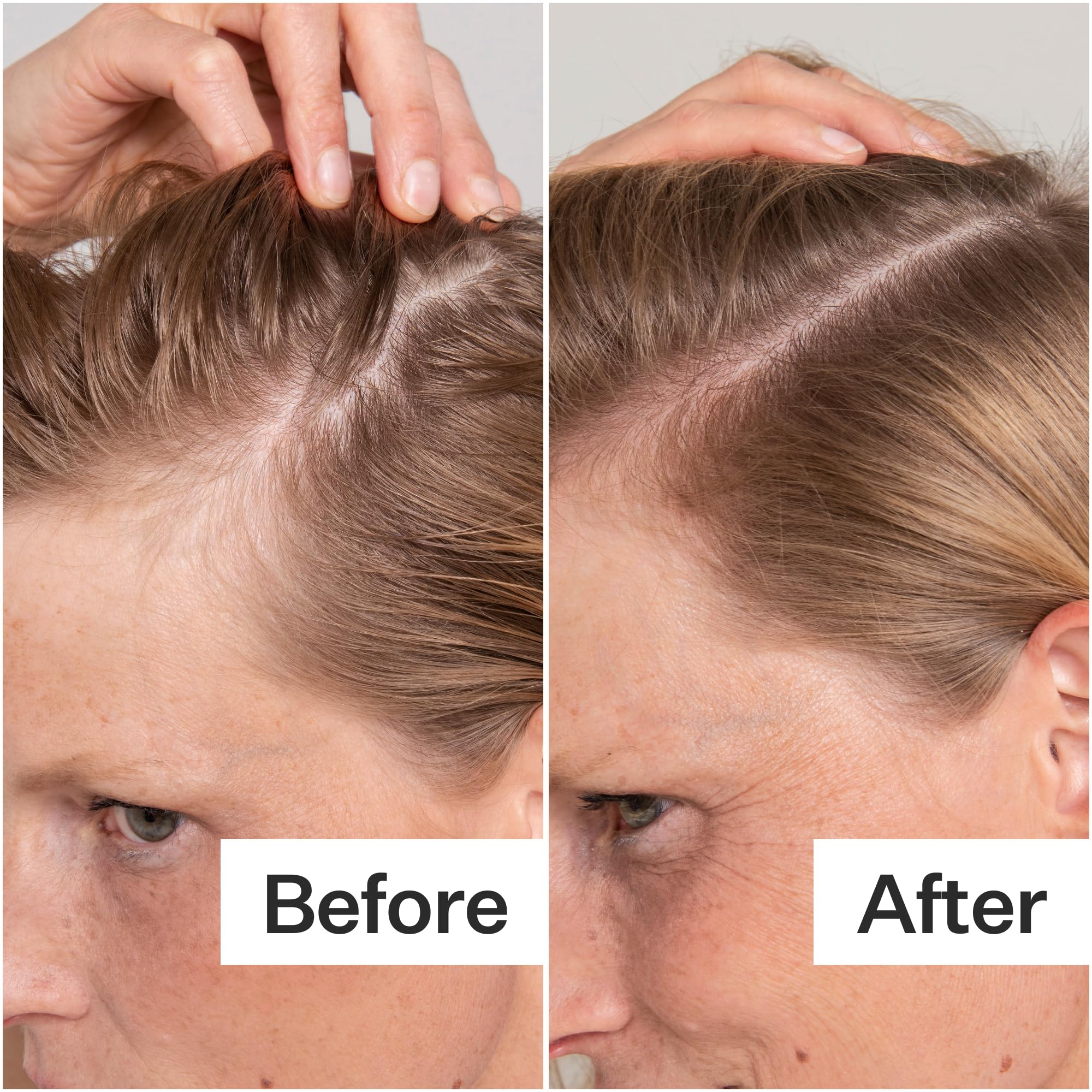ACT+ ACRE peppermint cooling-effect close-up signals soothing scalp comfort.