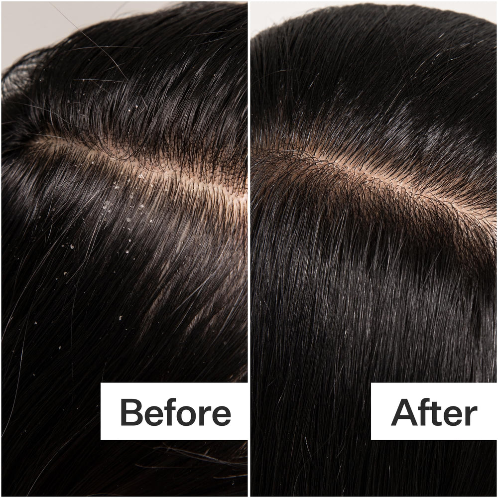 ACT+ ACRE fuller-looking hair after use with improved scalp health