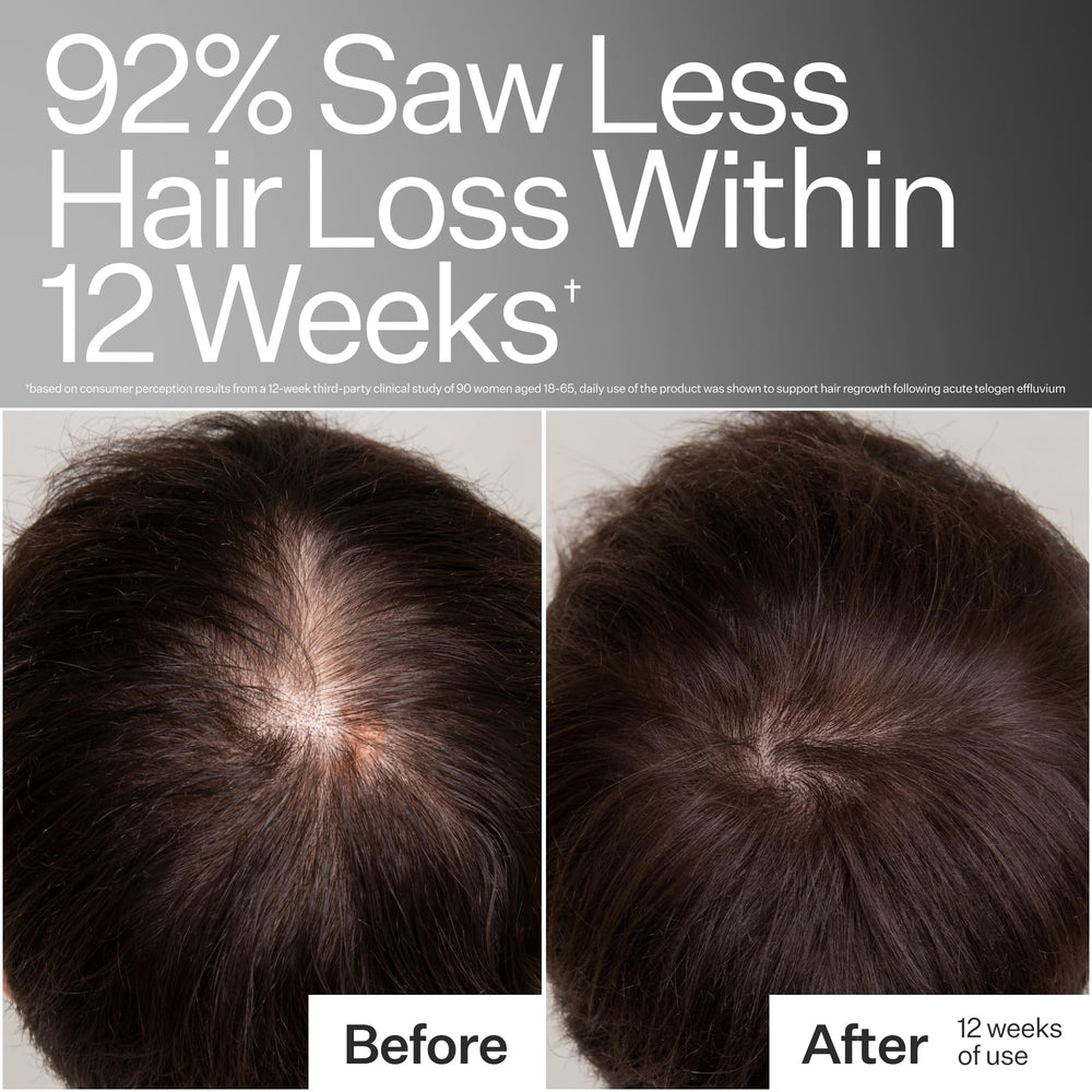 Act+Acre caffeine at hair root shows energizing scalp effect
