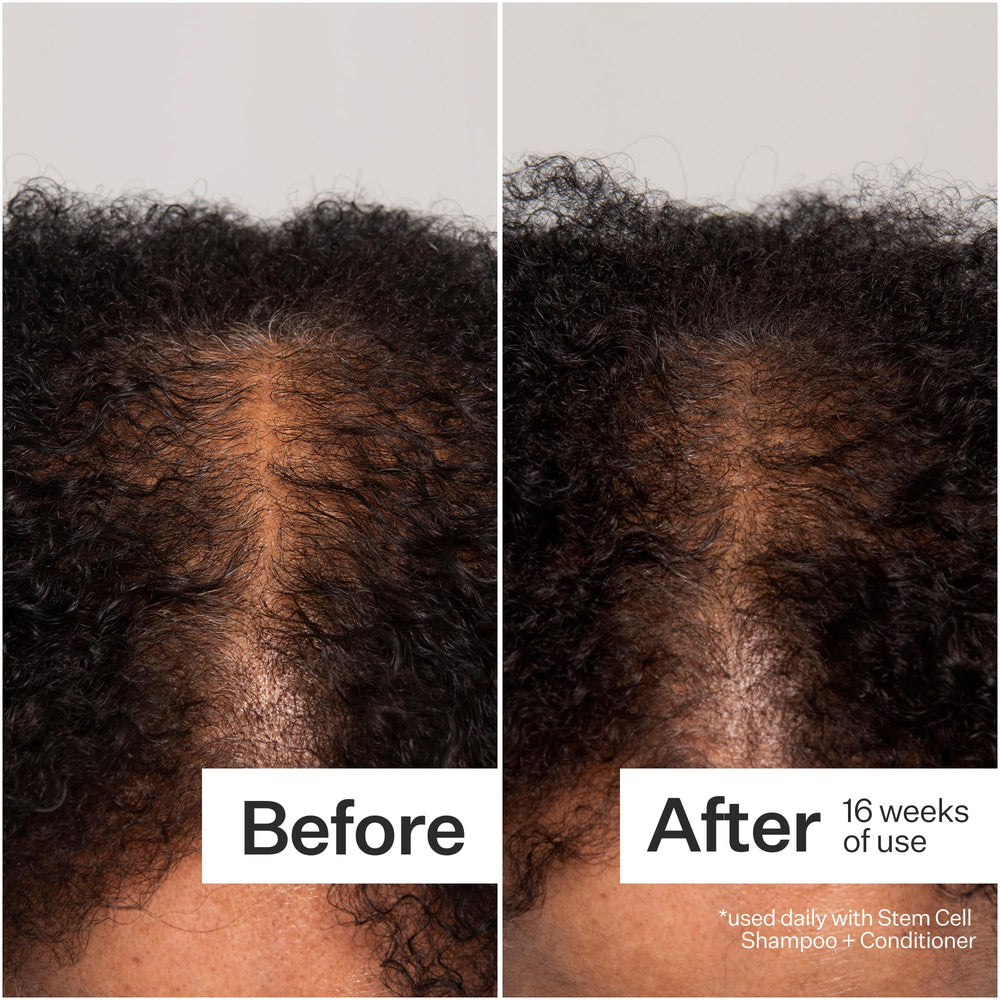 Act+Acre product image hints at slower shedding and visible improvement