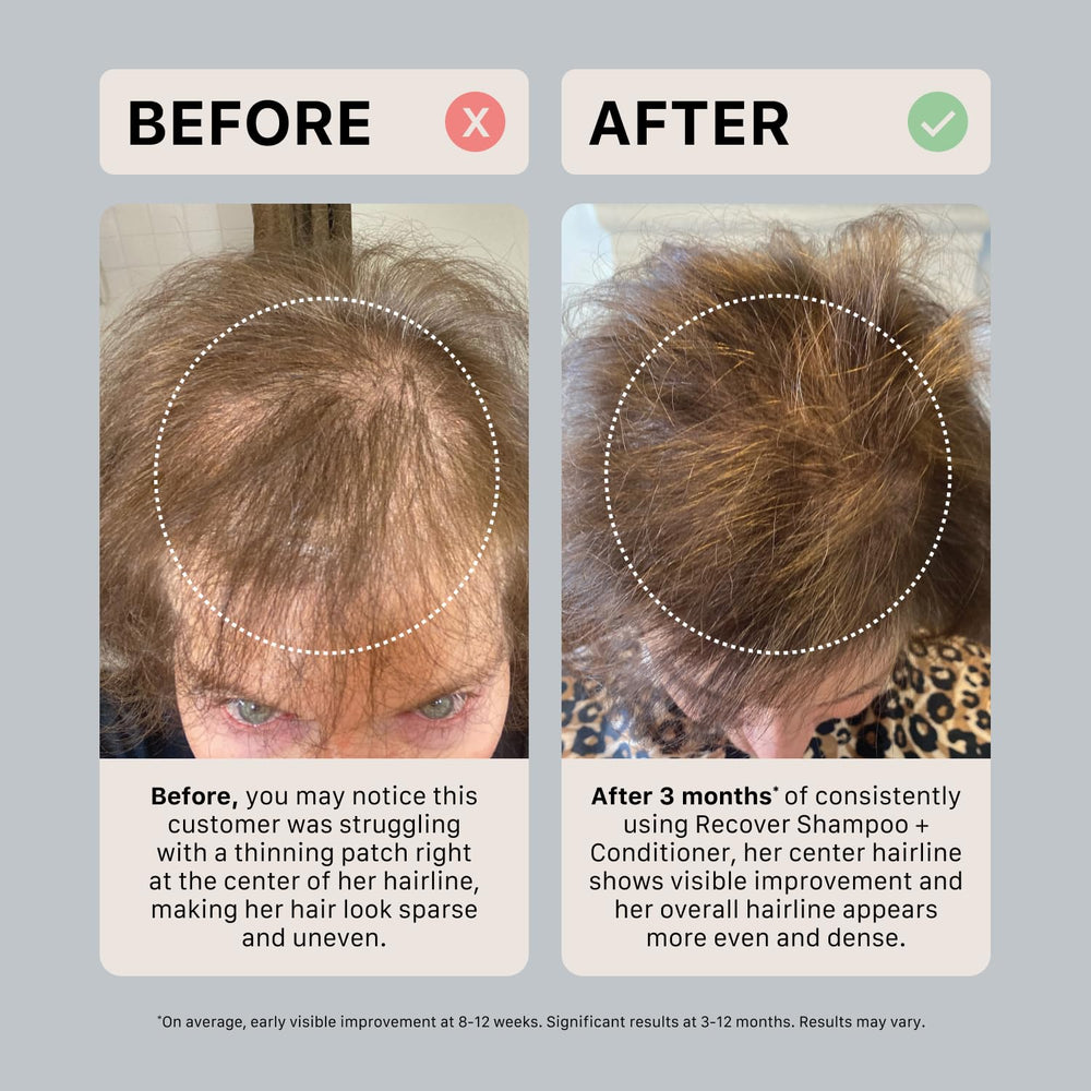 ACTIIV Recover flatlay of ingredients emphasizes plant-based components