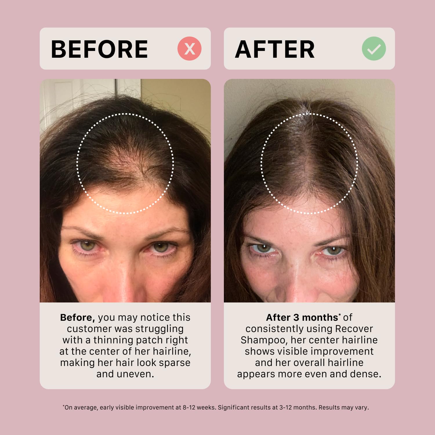ACTIIV Recover on bathroom shelf signals a luxurious beauty routine.
