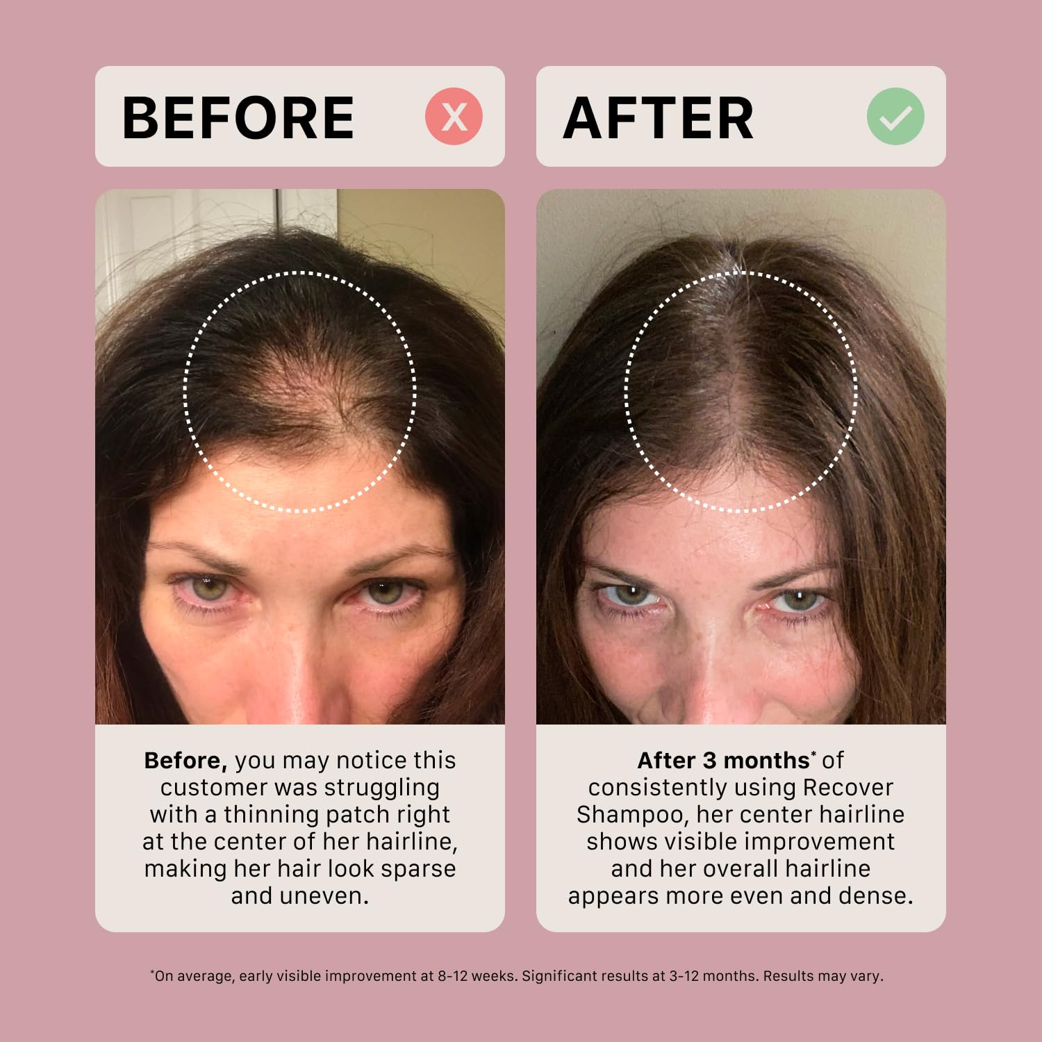ACTIIV Recover logo close-up indicates plant-based ingredients for gentle cleansing