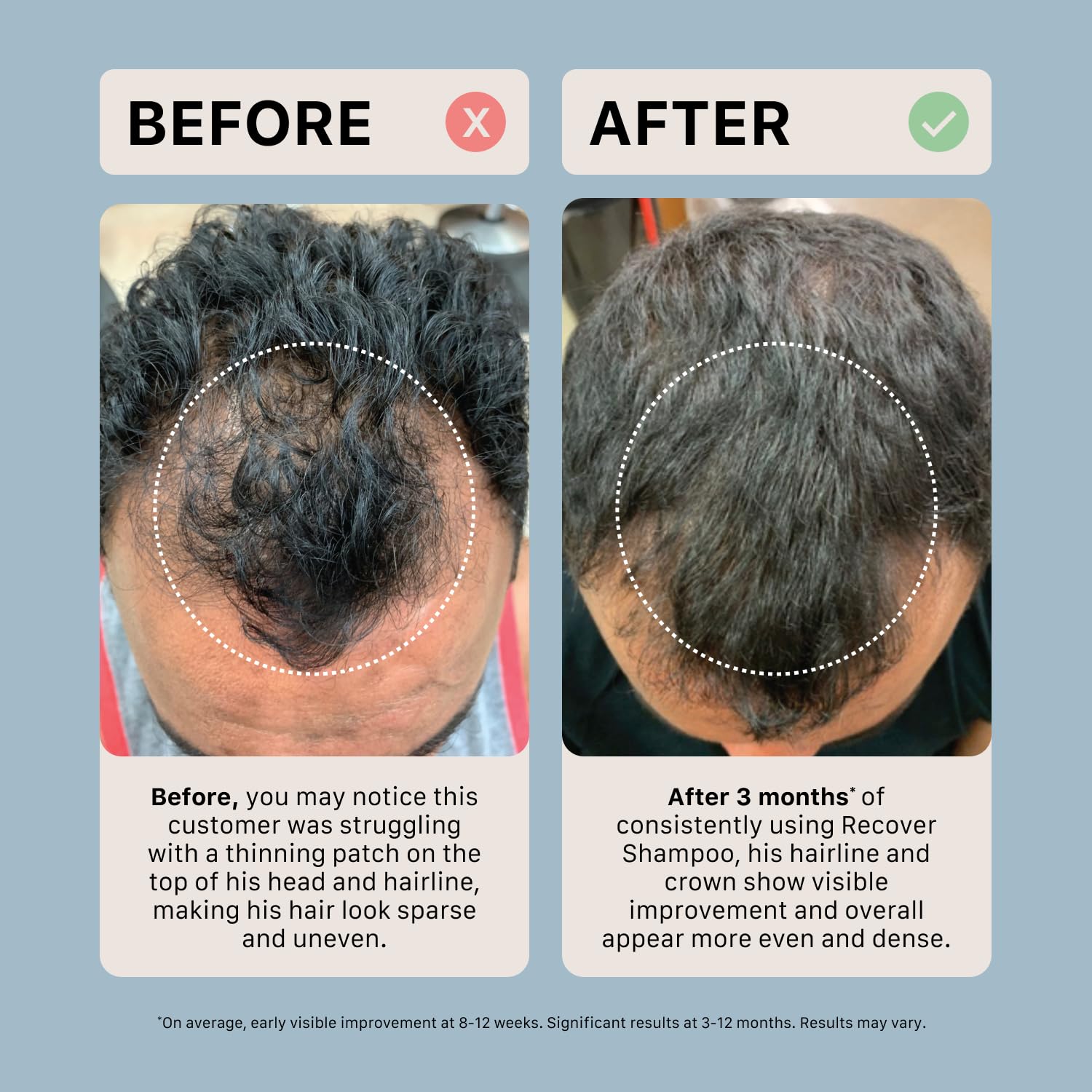 ACTIIV Recover Thickening Shampoo on shelf signals plant-based, color-safe care.
