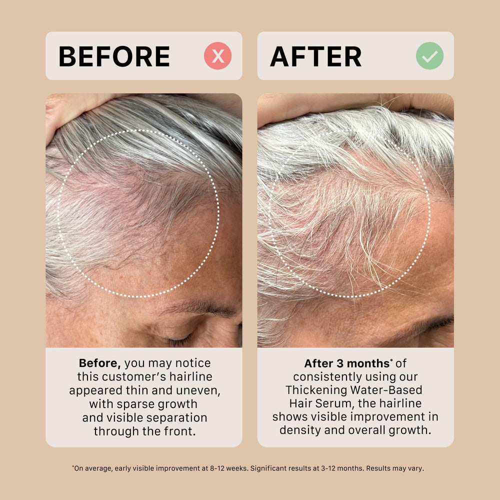 ACTIIV Thickening Hair Serum product shot emphasizing clean water-based design