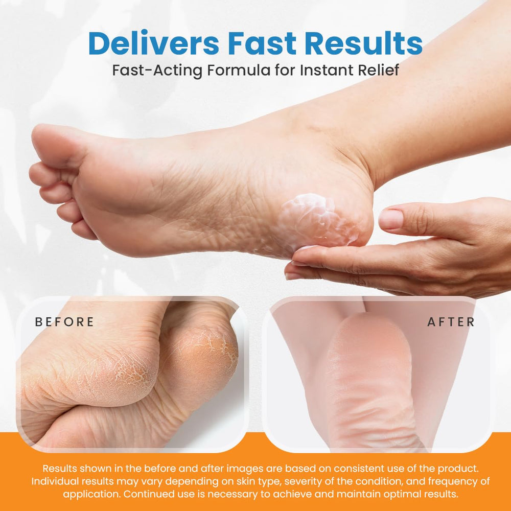 activelife Revitaderm supports multi-area foot care for hands, knees, elbows.
