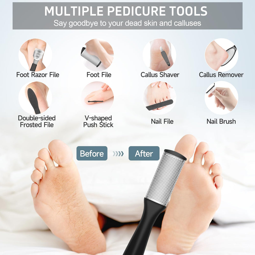 AdamPark foot care in action on feet, showing smoothing results