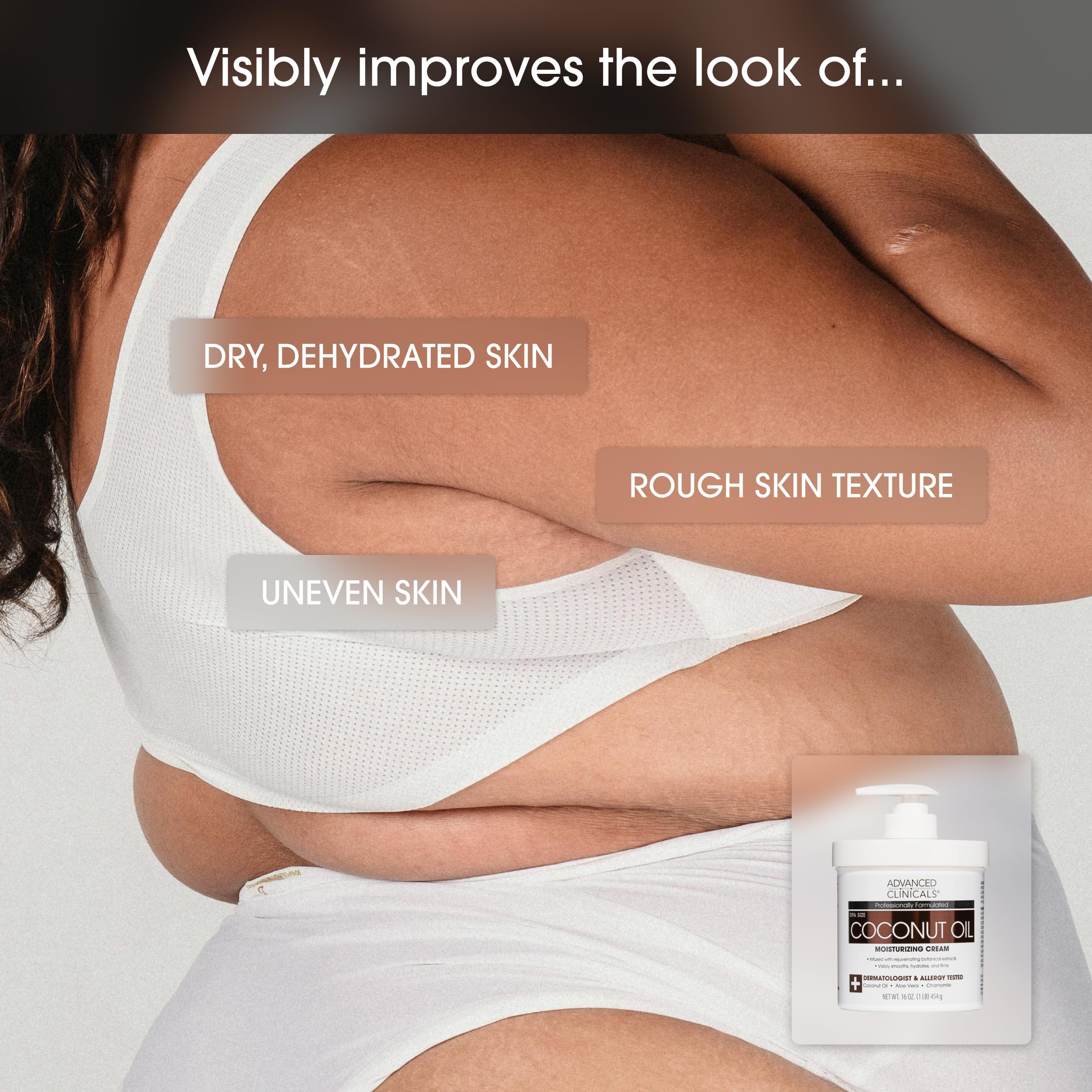 Advanced Clinicals Coconut Oil Body Cream with chamomile and aloe ingredients.