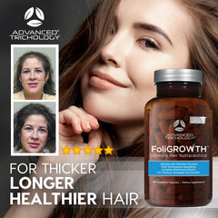 Advanced Trichology FoliGROWTH bottle label showcases Opti MSM and Biotin for nourishment.