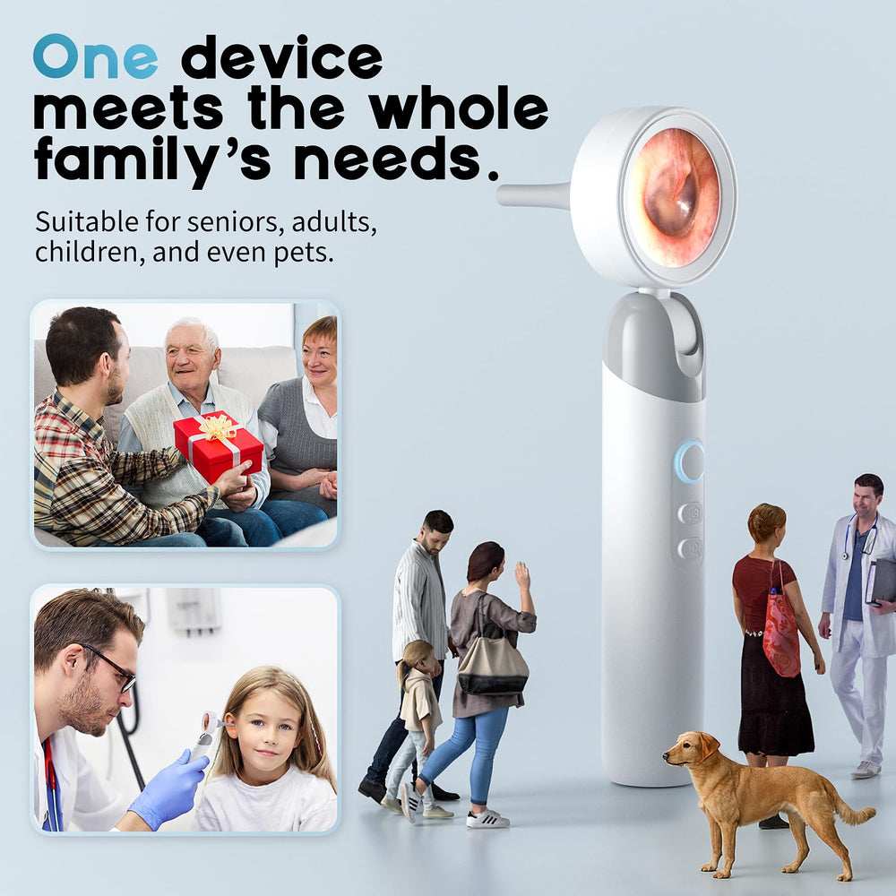 Aertnelz Otoscope 2000mAh battery for extended use