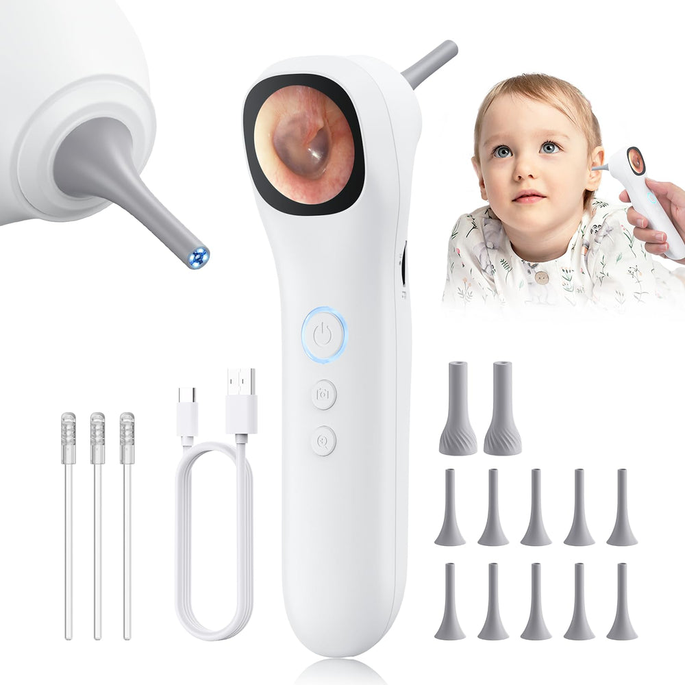 Aertnelz Otoscope Ear Camera 1.21-inch Screen enables clear ear inspections on the go.