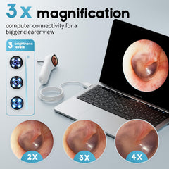 Aertnelz Otoscope Ergonomic Grip supports comfortable long sessions during home exams.