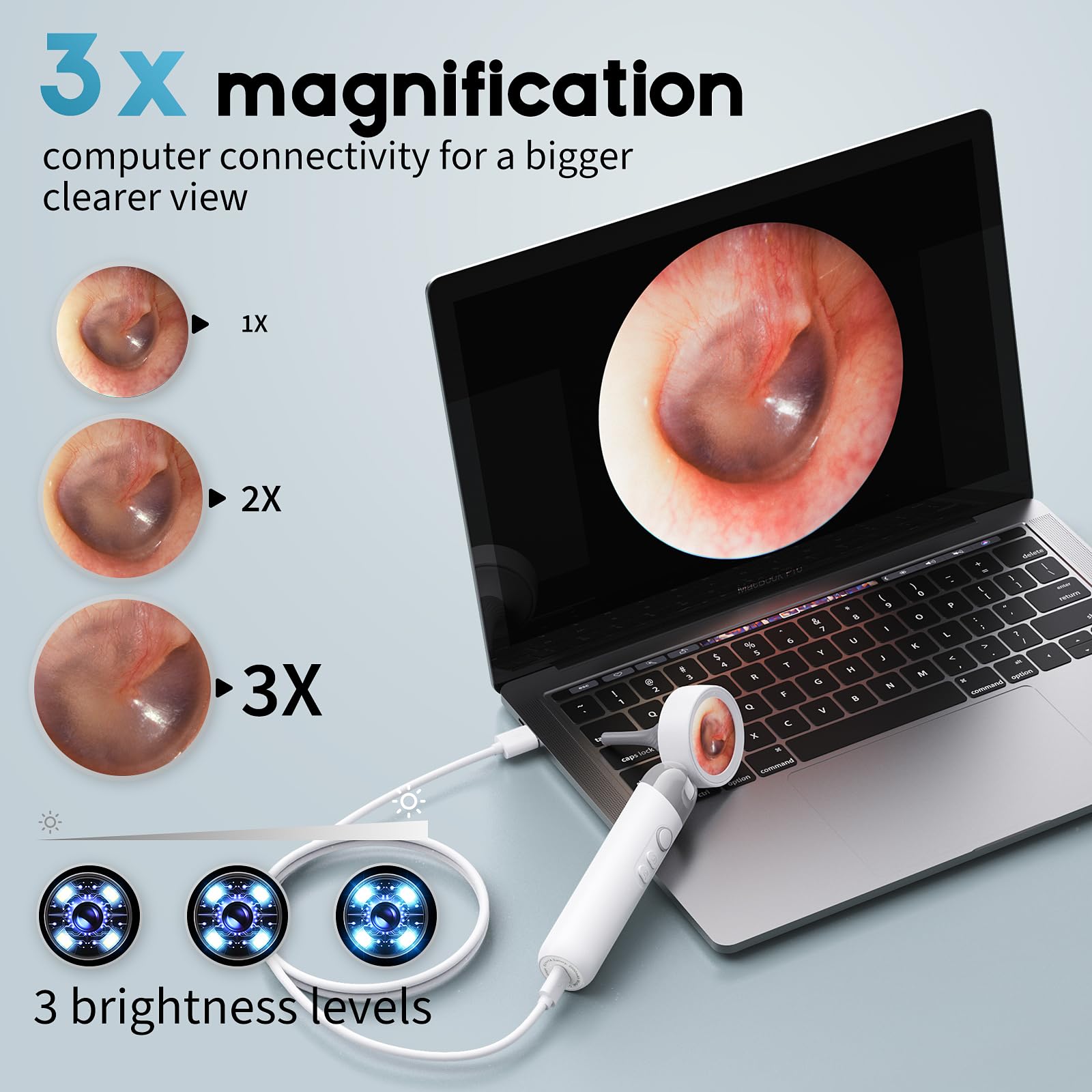 Aertnelz Otoscope magnification helps precise 3x zoom checks