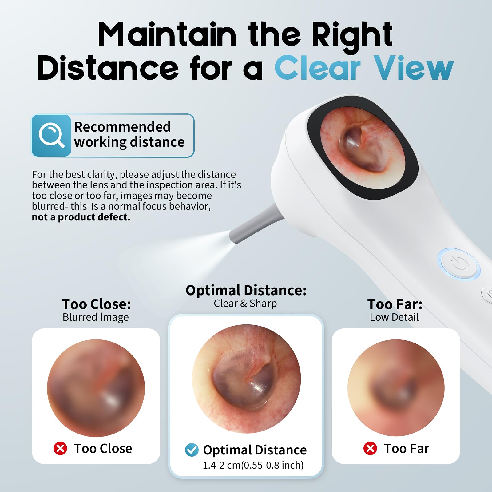 Aertnelz Otoscope Working Distance helps reduce blur and improve detail.