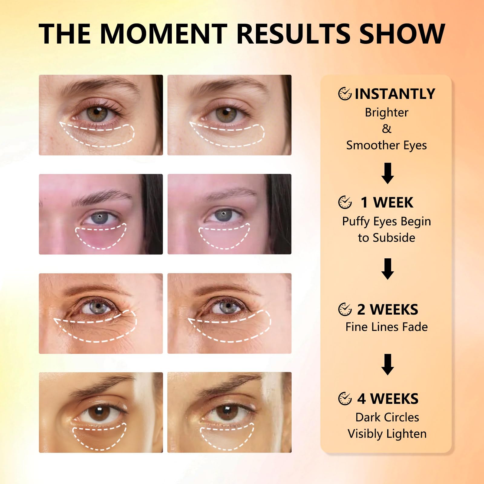 Aeryea Under Eye Patches collagen glow supports smoothing texture.