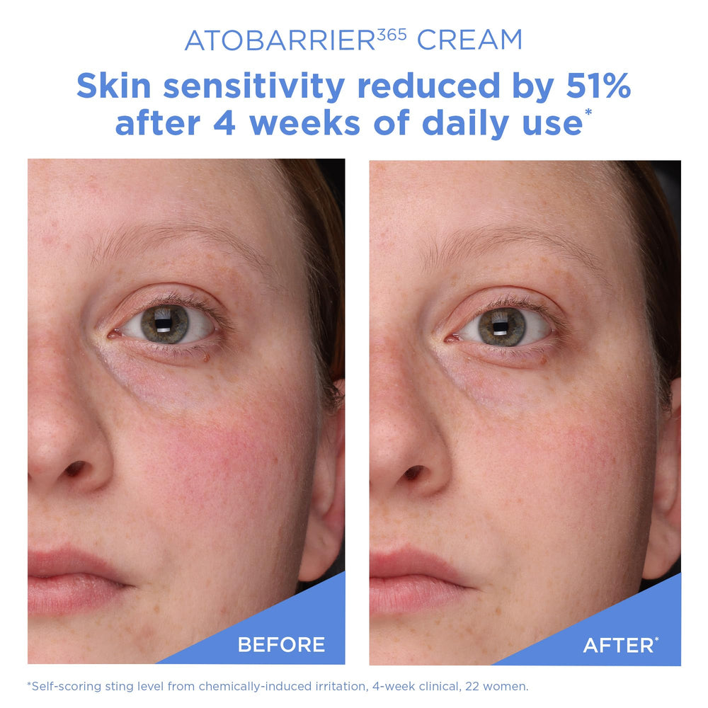AESTURA ATOBARRIER365 after-microneedling scene suggesting compatible post-care routine