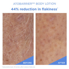 AESTURA ATOBARRIER365 box packaging communicates fragrance-free, eczema-friendly skincare.