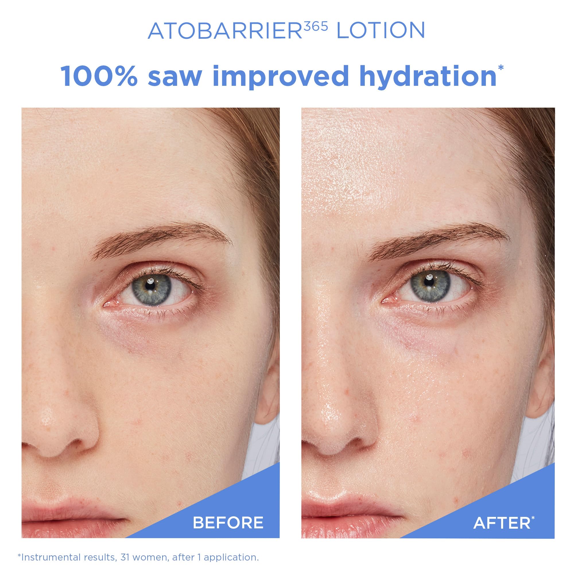 AESTURA ATOBARRIER365 fragrance-free formula suitable for sensitive skin use.