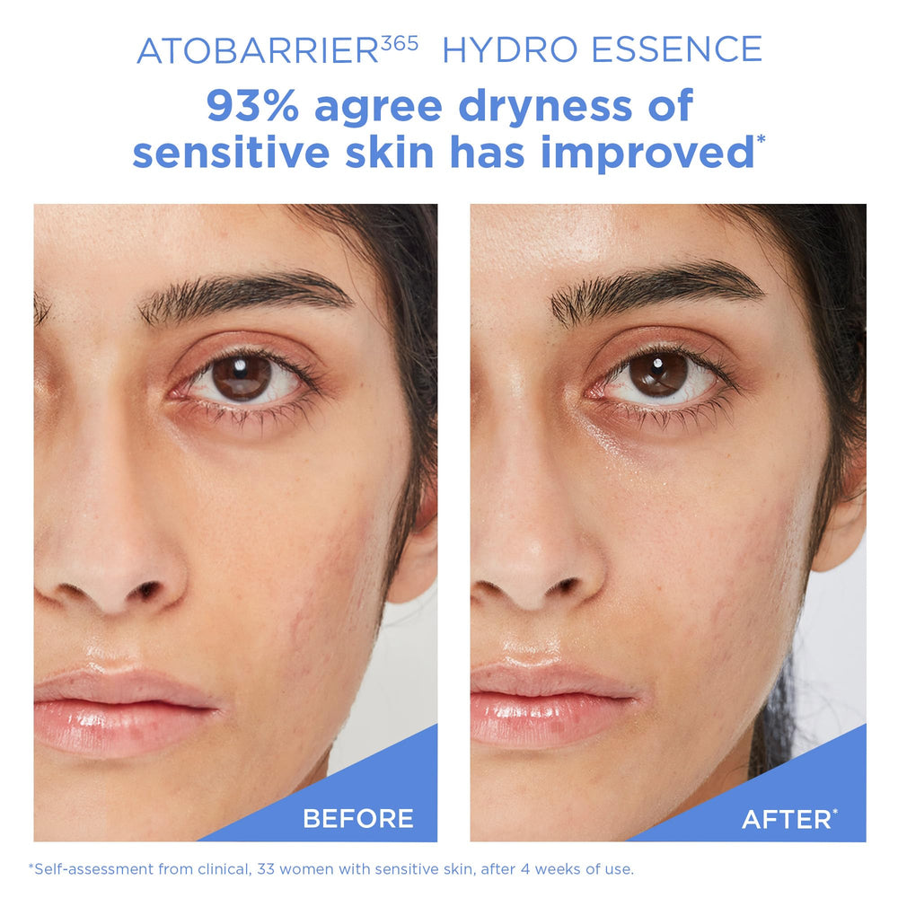 AESTURA ATOBARRIER365 Hydro Essence allergy-tested label shown on packaging