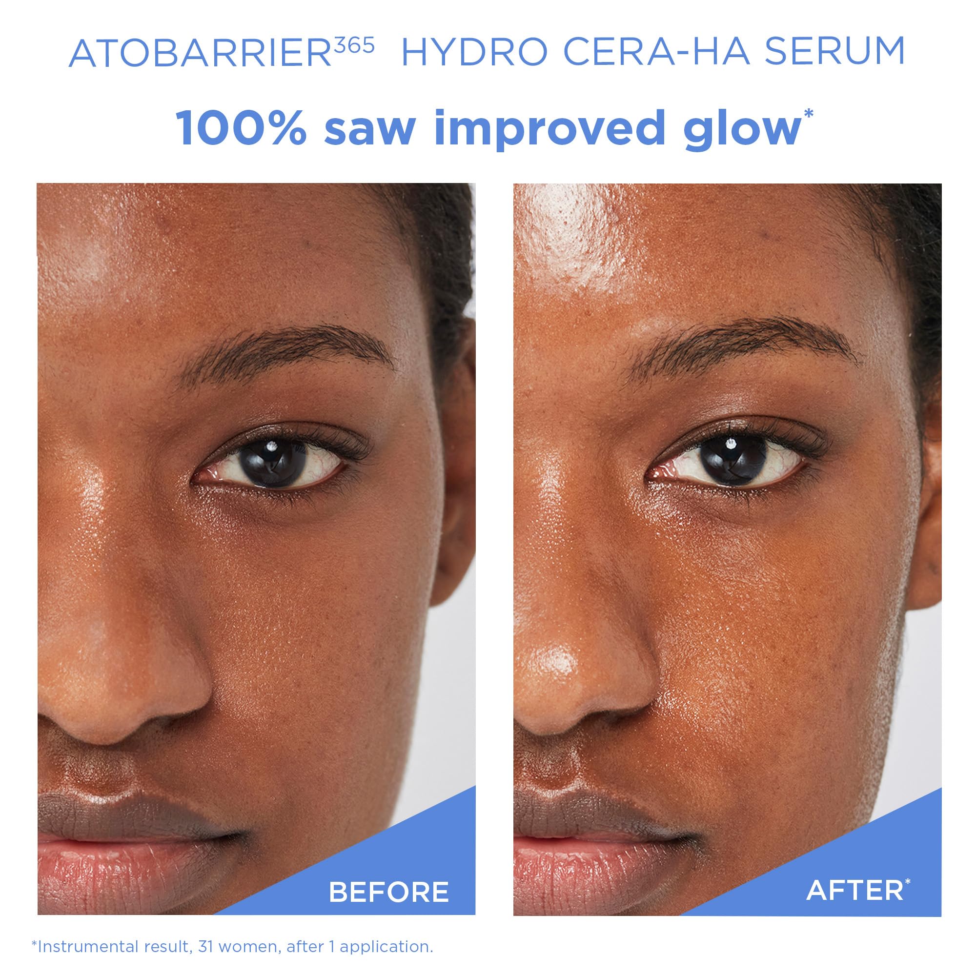 AESTURA ATOBARRIER365 skin glow after use for a healthier-looking complexion.