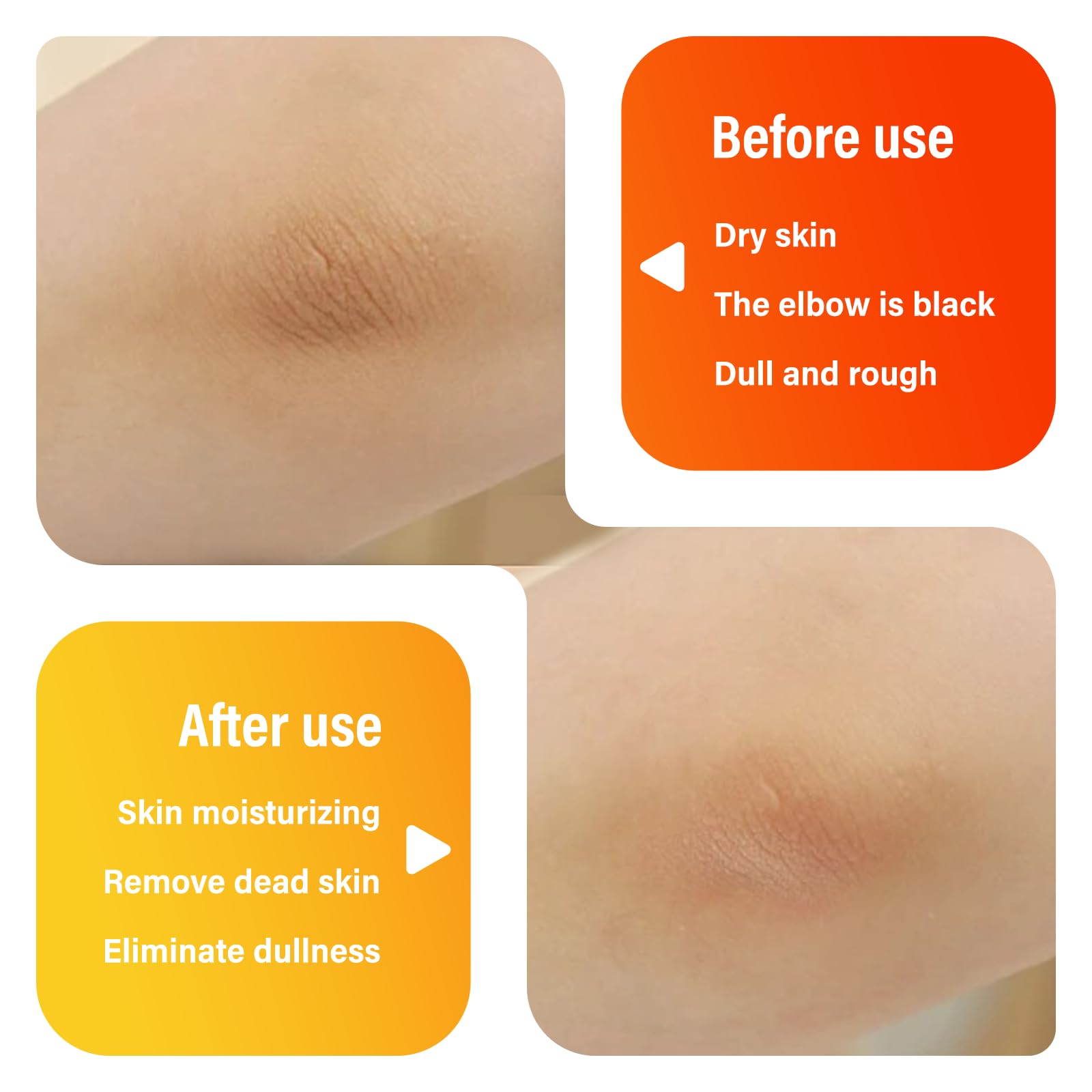 Aevezom Body Keratin Care Turmeric Spray applied to body to smooth patches.