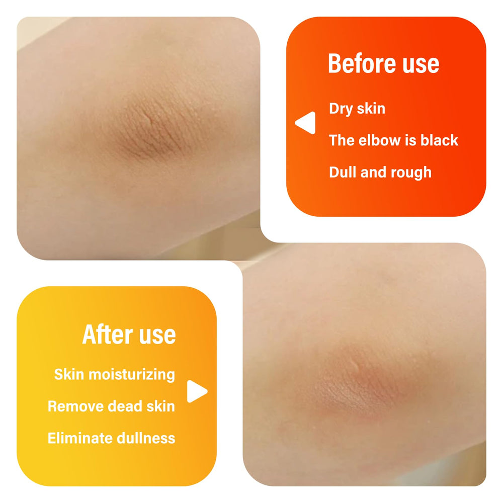 Aevezom Body Keratin Care Turmeric Spray applied to body to smooth patches.