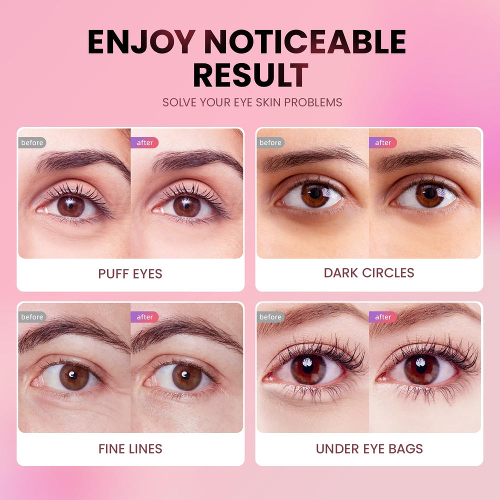AILEORY Under Eye Patches apply guide image for easy 15–20 minute use