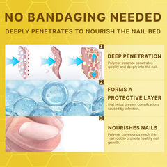Nail closeup showing textured nails and possible repair with Aimery