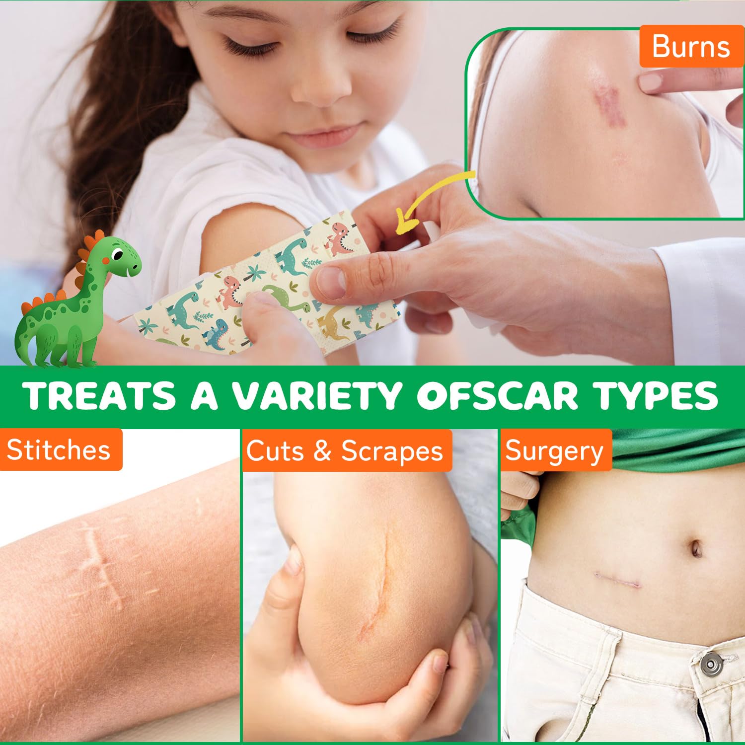 AirroYE Dinosaurs silicone scar sheet reuse and cleaning shows durability.