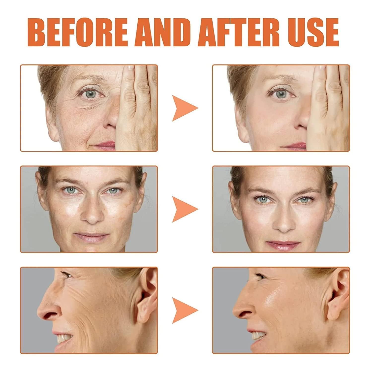 AKEASS skin elasticity illustration suggesting firmer, more resilient skin.
