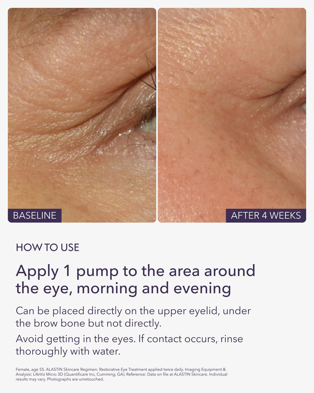 ALASTIN Restorative Eye Treatment ingredients illustration highlights nourishing components