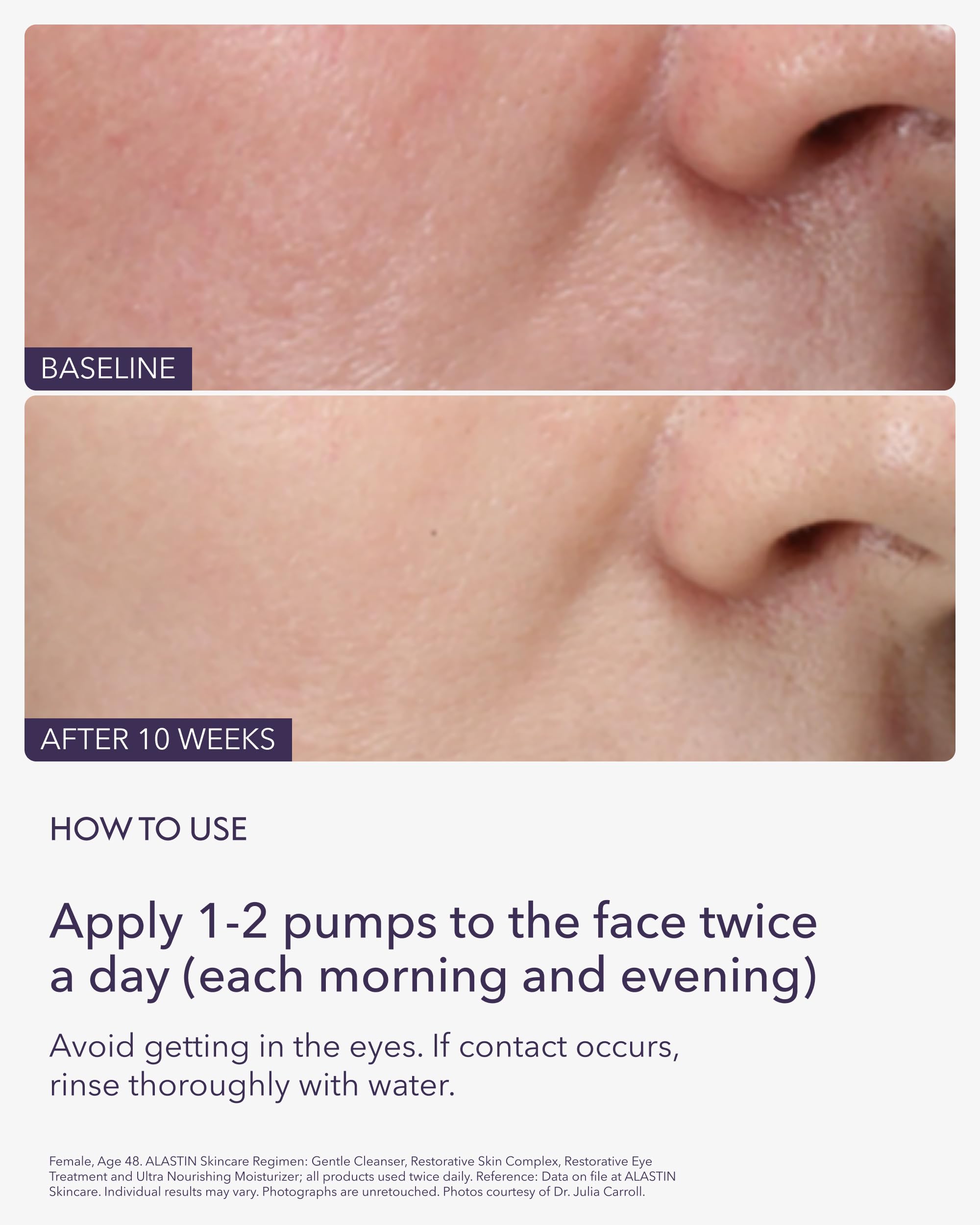 ALASTIN Restorative Skin Complex ingredients scene hints at elastin support and texture