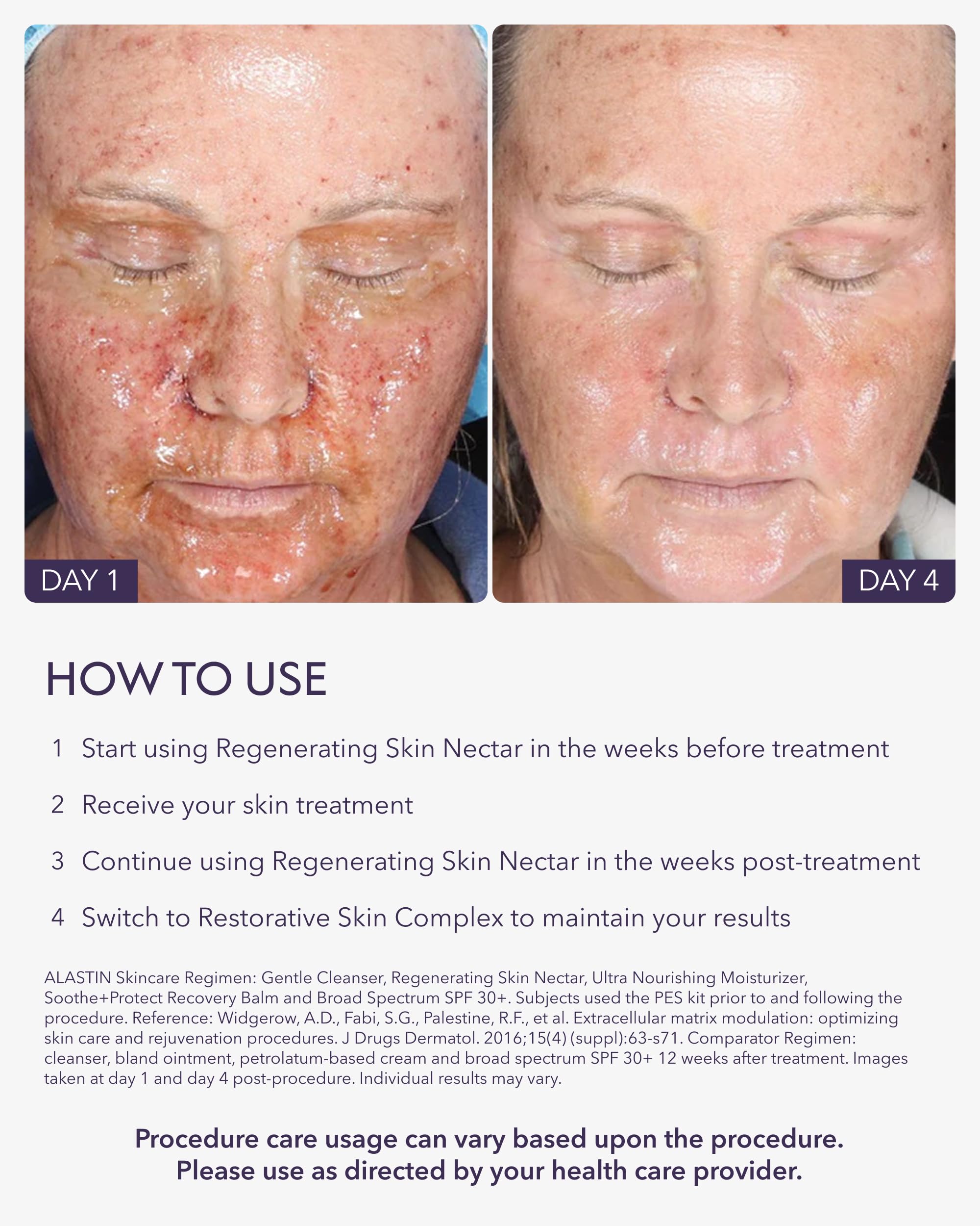 ALASTIN Regenerating Skin Nectar ingredients arnica closeup highlights soothing post procedure support