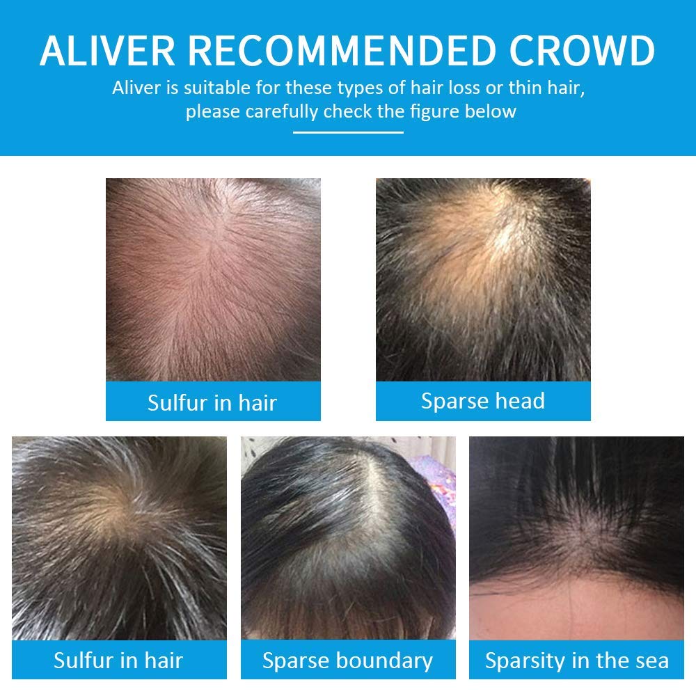 ALIVER before-after scene shows noticeable fullness and natural texture