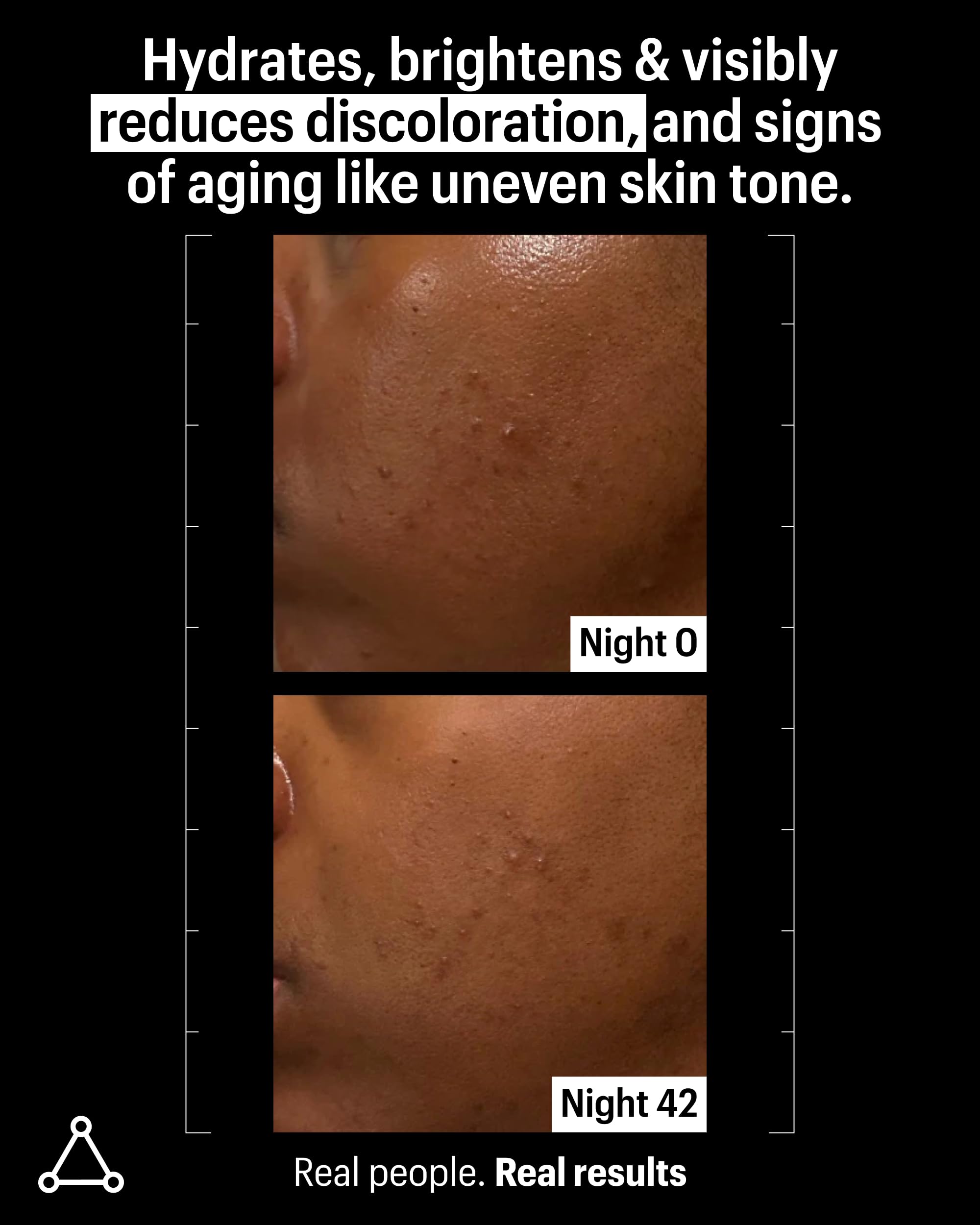 Allies of Skin salicylic acid closeup supports clear pores and refined texture.
