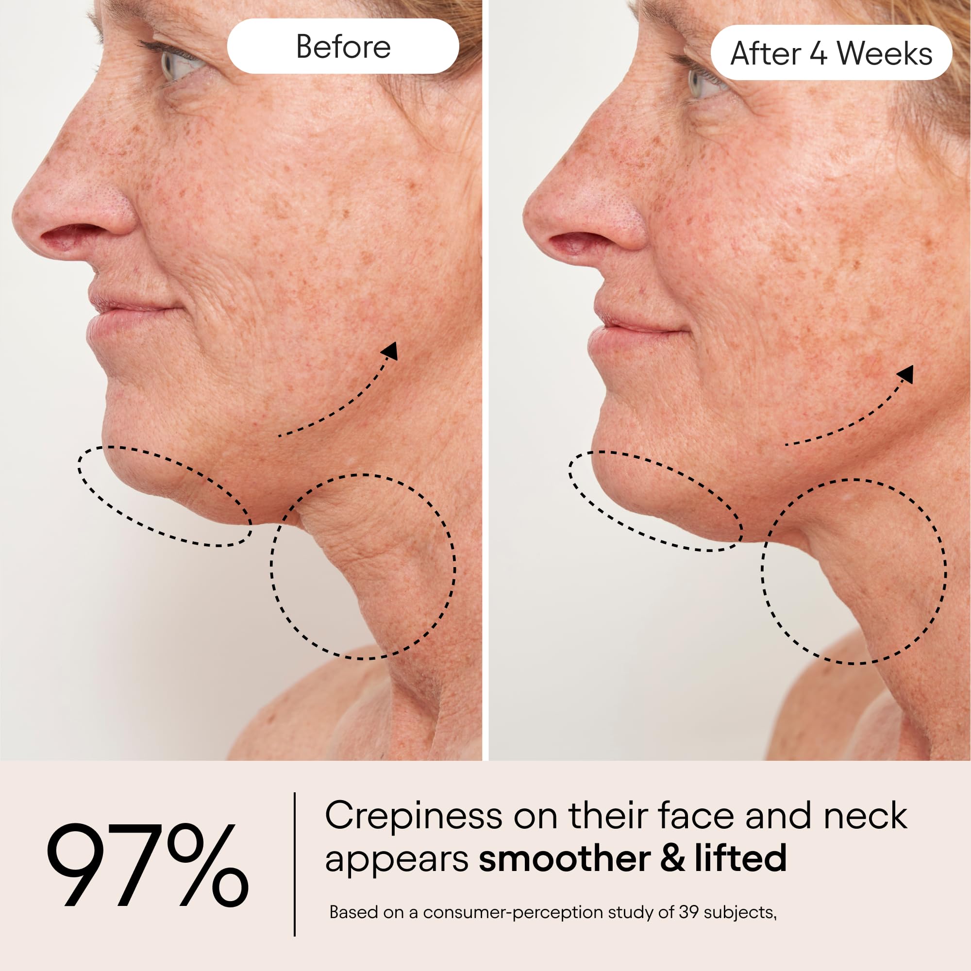 Alpyn Beauty Apple fruit extract visual suggests nourishing texture.