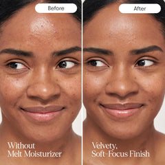 Alpyn Beauty Melt Moisturizer with bakuchiol smooths fine lines.
