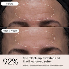 Alpyn Beauty Melt Moisturizer uses wild plants to boost skin resilience in challenging climates.