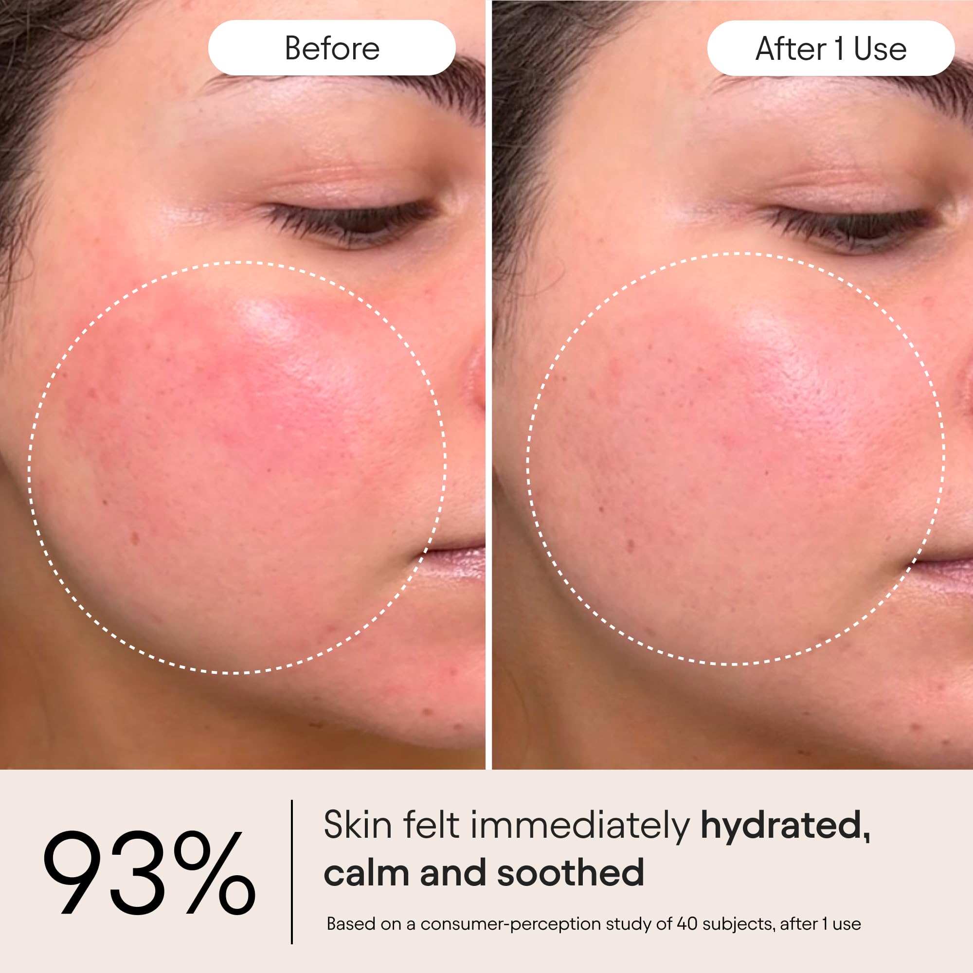 Alpyn Beauty Rich cream texture on skin indicates comfort and barrier support.
