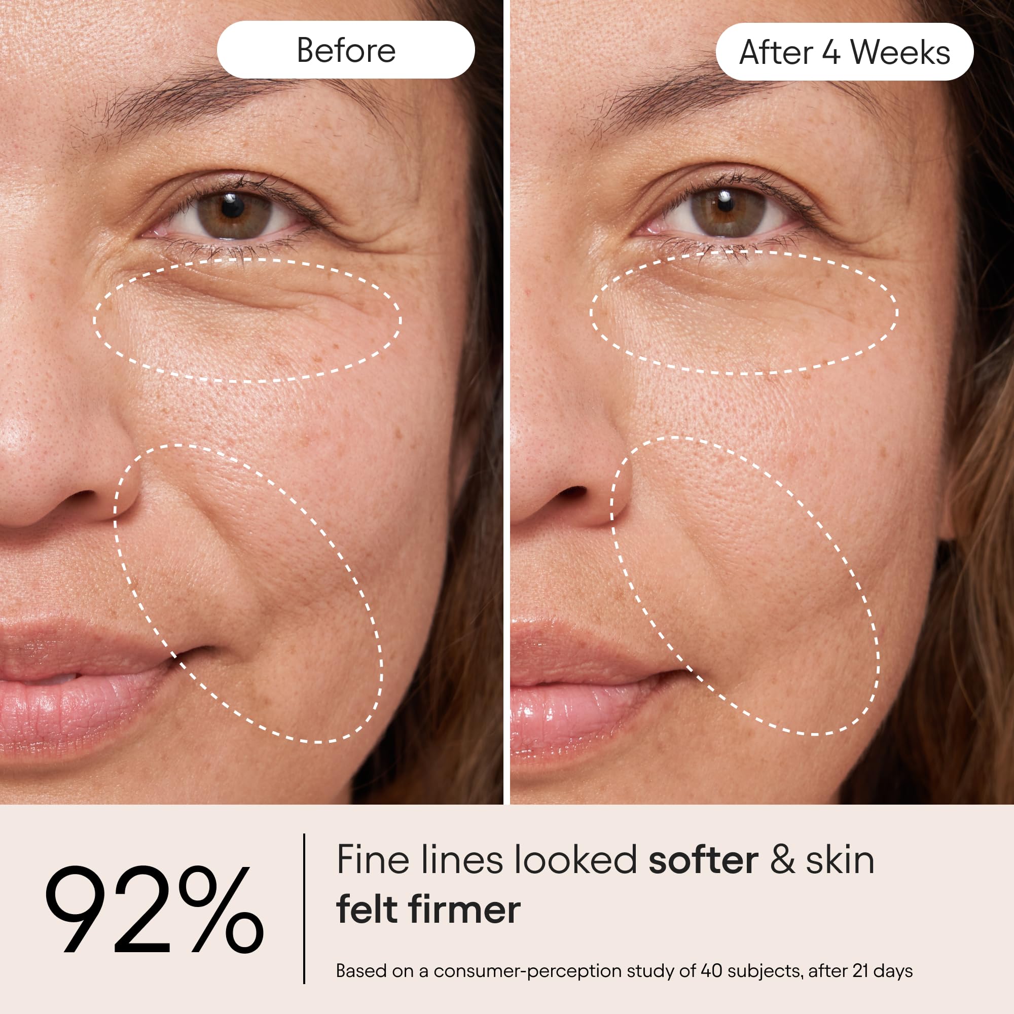Alpyn Beauty Snap 8 peptide application demonstrates wrinkle-relief potential.