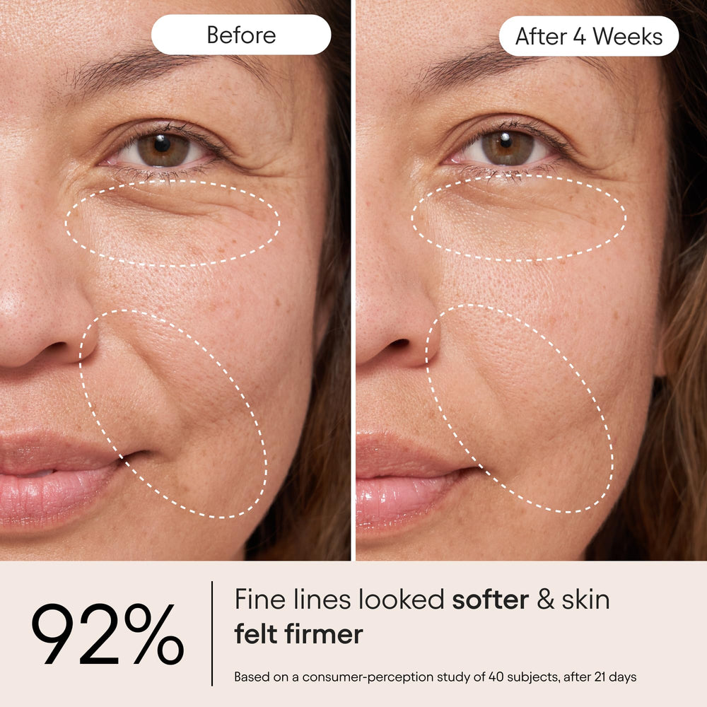 Alpyn Beauty Snap 8 peptide application demonstrates wrinkle-relief potential.