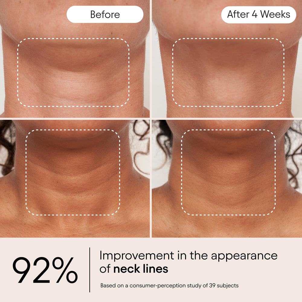Alpyn Beauty Super Sculpt Serum on the face for smoother skin.