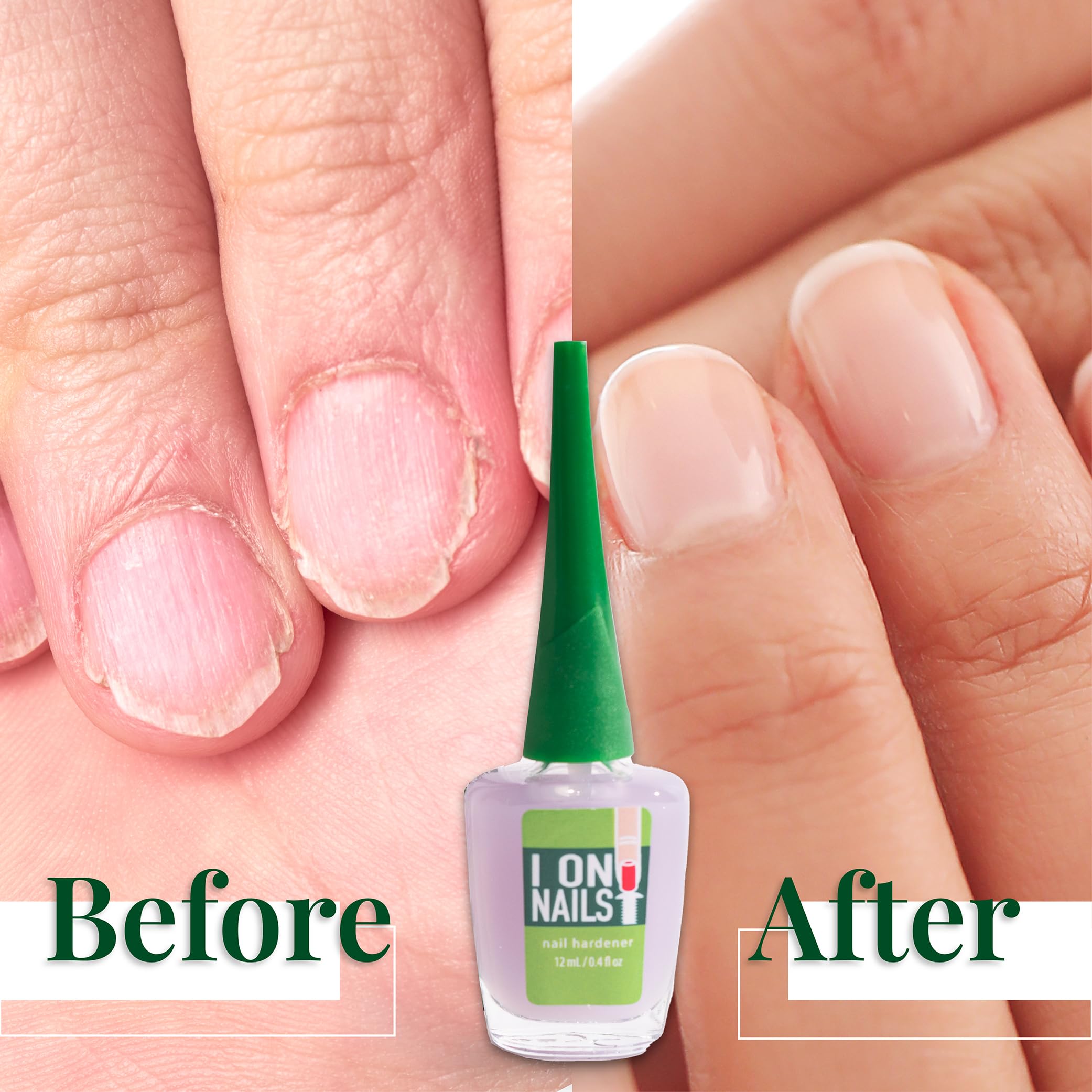 Amen Beauty I On Nails growth-boost application supports healthier nail growth.