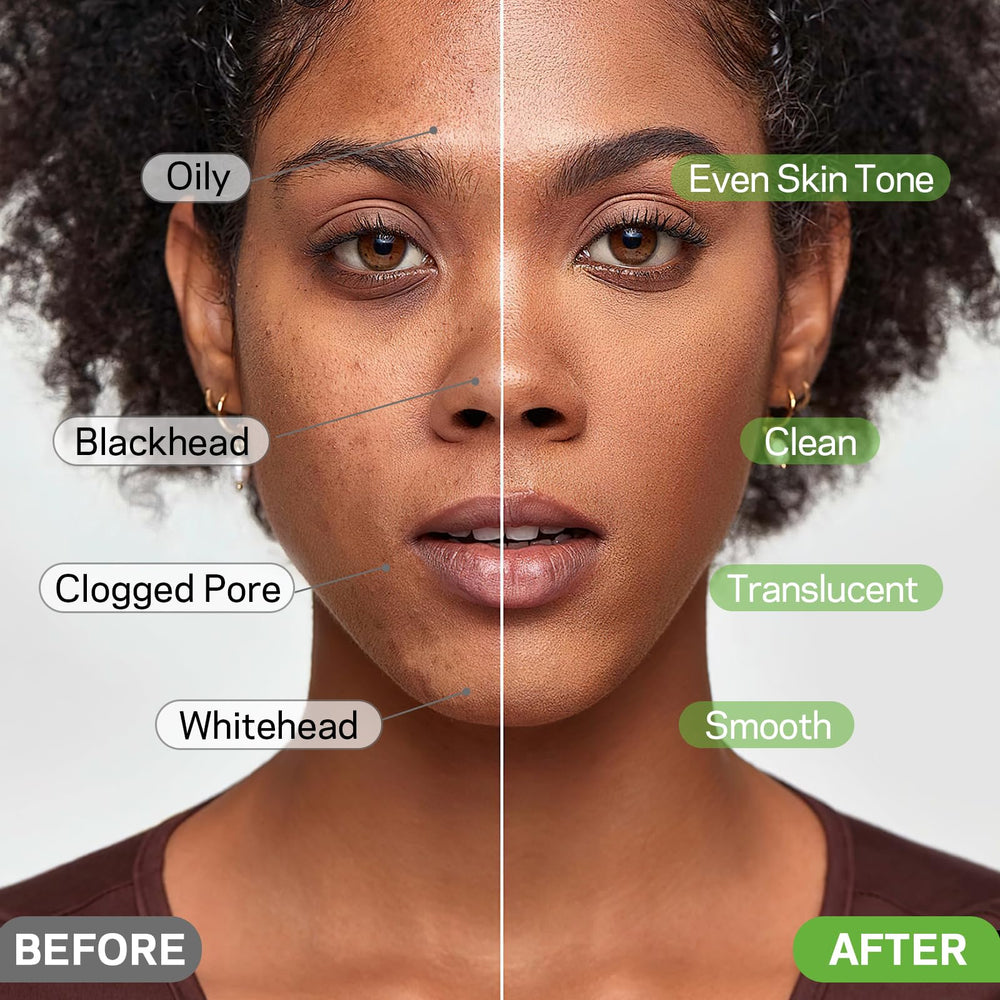 AMOADO Deep Cleanse Pore Clarity with activated charcoal for oil control.