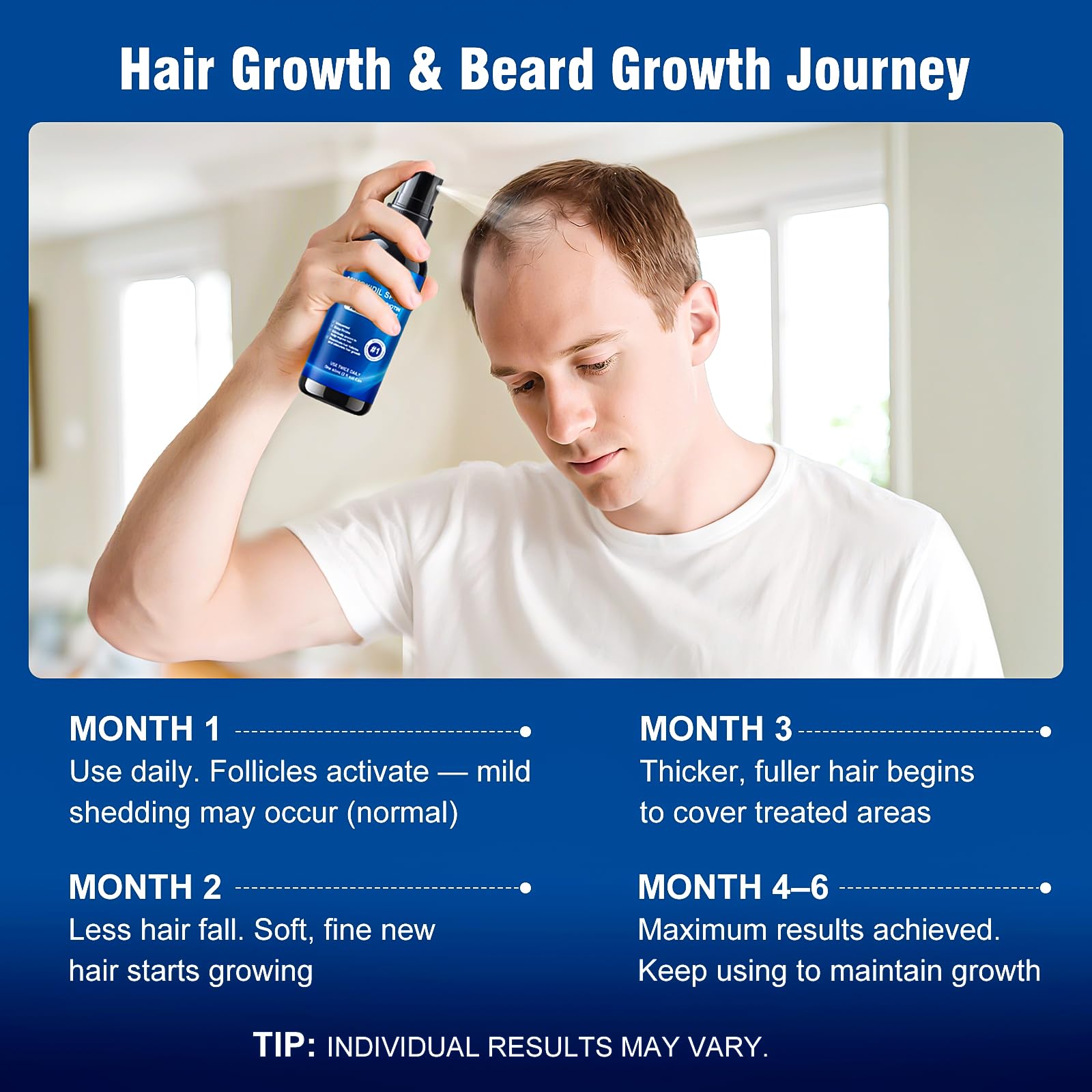 AMRWRIR unscented minoxidil solution suitable for sensitive scalps